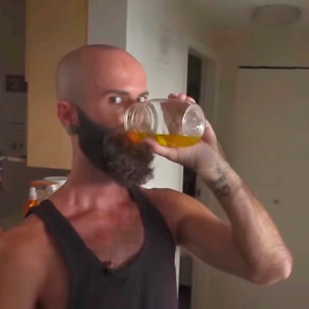 Victims of urine therapy